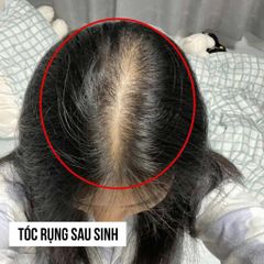 Viên Uống Hỗ Trợ Mọc Tóc Biotin Brewer's Yeast Sejong - Hộp 60 Viên, Giúp Tóc Khỏe, Giảm Rụng, Tăng Độ Dày Tóc