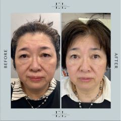 Sữa Rửa Mặt Dịu Nhẹ Hyaestic 1% BHA - Làm Sạch Sâu, Giảm Bã Nhờn, Dưỡng Ẩm Cho Mọi Loại Da 150ml