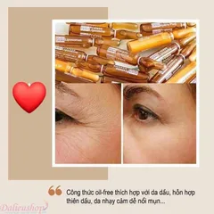 Tinh Chất Martiderm The Originals Proteos Liposome 30 Amoules - Chống Oxy Hóa, Cấp Ẩm, Giảm Nhờn và Mụn cho Da Nhạy Cảm