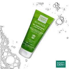 Martiderm Acniover Gel Rửa Mặt Cho Da Dầu & Mụn 200ml - Dưỡng Ẩm Sâu, Chống Oxy Hoá, Se Khít Lỗ Chân Lông, Chính Hãng