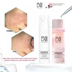 Tinh Chất Cân Bằng Da Mụn RVB LAB THE SKIN 30ml - Serum Giảm Sưng Đỏ, Kiểm Soát Dầu, Thu Nhỏ Lỗ Chân Lông, Phù Hợp Da Nhạy Cảm