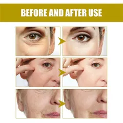 HD Derma Professional Hydrating Relaxaderm - Tinh Chất Dưỡng Ẩm Toàn Diện Cấp Nước 48 Giờ, Làm Sáng Mịn Da