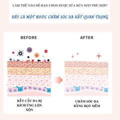 💗  ĐỪNG BỎ LỠ CƠ HỘI LÀM ĐẸP VỚI CICA DEEP CLEANSING FOAM - Sữa Rửa Mặt Làm Sạch Sâu Hàn Quốc - BÍ QUYẾT LÀM ĐẸP   💗