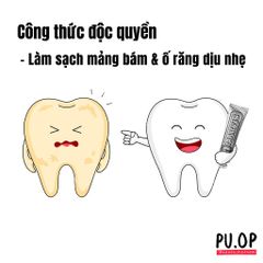 Kem Đánh Răng Marvis Hương Bạc Hà - Trắng Răng, Chống Ố Vàng, Ngừa Sâu Răng, Sản Phẩm Cao Cấp Từ Ý, Hơi Thở Thơm Mát