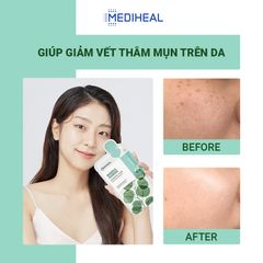 Mặt Nạ Giấy Mediheal Essential Mask Hộp 10 Miếng 24ml - Chăm Sóc Da, Cấp Ẩm, Giảm Mụn, Làm Sáng Da, Phù Hợp Mọi Loại Da