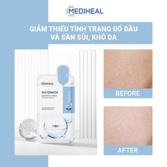 Mặt Nạ Giấy Mediheal Essential Mask Hộp 10 Miếng 24ml - Chăm Sóc Da, Cấp Ẩm, Giảm Mụn, Làm Sáng Da, Phù Hợp Mọi Loại Da