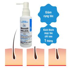 Set 3 Chai Xịt Mọc Tóc Minoxidil Bailleul 2% Từ Pháp - Giải Pháp Hiệu Quả Cho Tóc Rụng và Hói, Kích Thích Mọc Tóc Mới