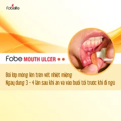 Gel Nhiệt Miệng Fobe - Chai 10/15g, Giảm Đau Nhanh, Chống Viêm Loét Miệng Từ Thiên Nhiên, Đạt Chuẩn GMP