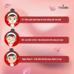 Combo 3 Kem Giảm Mụn Đầu Đen, Đầu Trắng và Mụn Cám ACNEVIR SANTAFA 15gr - Giải Pháp Đặc Trị Da Mụn Hiệu Quả