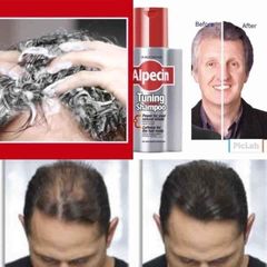 Dầu gội ALPECIN Tuning Shampoo 200ml - Chống rụng tóc và làm đen tóc bạc, cứu tinh cho mái tóc chắc khỏe