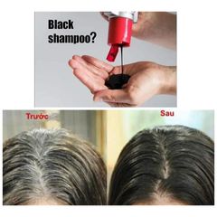 Dầu gội ALPECIN Tuning Shampoo 200ml - Chống rụng tóc và làm đen tóc bạc, cứu tinh cho mái tóc chắc khỏe