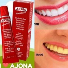Kem Đánh Răng Ajona 25ml - Chăm Sóc Răng Miệng Trắng Sáng, Ngăn Ngừa Hôi Miệng và Viêm Nướu, Phù Hợp Mọi Lứa Tuổi