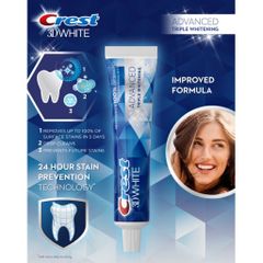 Kem đánh răng CREST 3D White Advanced Triple Whitening