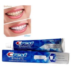Kem đánh răng CREST 3D White Advanced Triple Whitening