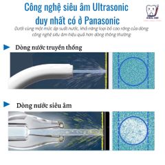 TĂM NƯỚC PANASONIC EW1511-CÔNG NGHỆ SIÊU ÂM MỚI NHẤT, XỊN XÒ NHẤT