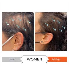 Dầu Xả Kích Mọc Tóc Revita - Ngăn Ngừa Gãy Rụng, Chăm Sóc Tóc Khỏe Mạnh, Dưỡng Ẩm, Không Silicone, Paraben, Dầu Khoáng