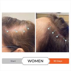 Dầu Xả Kích Mọc Tóc Revita - Ngăn Ngừa Gãy Rụng, Chăm Sóc Tóc Khỏe Mạnh, Dưỡng Ẩm, Không Silicone, Paraben, Dầu Khoáng