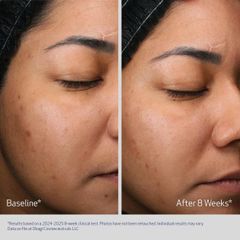 Kem Dưỡng Tái Tạo & Trẻ Hóa Da Ban Đêm Obagi Medical Retinol + PHA 50ml - Chăm Sóc Da Chuyên Sâu, Sáng Mịn, Giảm Nếp Nhăn