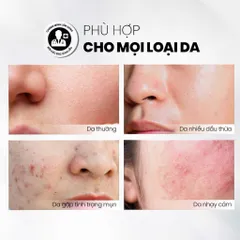 MD CARE MANDE EXFO 10ml - Tẩy Tế Bào Chết Mandelic Acid Dành Cho Da Nhạy Cảm, Căng Bóng, Làm Sáng, Mờ Nếp Nhăn, Chống Oxy Hóa
