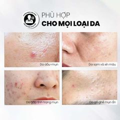 MD CARE Sữa Rửa Mặt BHA Dạng Bọt - Giảm Nhờn, Ngăn Ngừa Mụn, Làm Sạch Lỗ Chân Lông, Dưỡng Ẩm Cho Da Dầu & Nhạy Cảm (200ml)