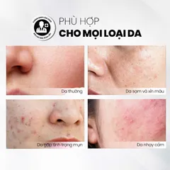 Tẩy Tế Bào Chết MD CARE Glow Exfo 10ml - AHA Làm Sáng Da, Giảm Thâm, Đều Màu Da, Phục Hồi Da Mụn
