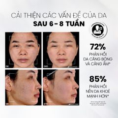 MD CARE Sữa Rửa Mặt Mandelic 5% - Gel Dịu Nhẹ Cấp Ẩm, Làm Sạch Lỗ Chân Lông, Giảm Mụn, Tẩy Tế Bào Chết Cho Da Rạng Rỡ 200ml