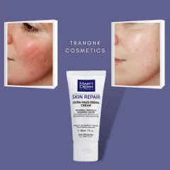 Kem Dưỡng Tái Tạo Da Nhạy Cảm Martiderm Skin Repair Cicra-Vass Cream 2ml - Chăm sóc làn da tổn thương, làm dịu và phục hồi nhanh chóng