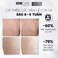 Sữa Tắm Giảm Mụn Lưng MD CARE C.L.E.A.N.S.E - Tẩy Tế Bào Chết Cho Da Sáng Mịn, Chống Viêm Mụn, Dung Tích 200ml