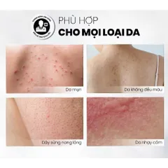 MD CARE Tẩy Tế Bào Chết Body AHA BHA Exfoliating Body Spray 100ml - Giảm Mụn Lưng, Làm Sáng Da, Phục Hồi Kết Cấu Da