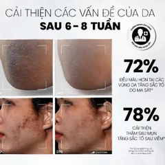 Kem Dưỡng Sạch Da MD CARE - Mờ Thâm Mụn, Nám và Tàn Nhang, Tăng Cường Độ Sáng và Collagen, Dành Cho Da Nhạy Cảm 50ml