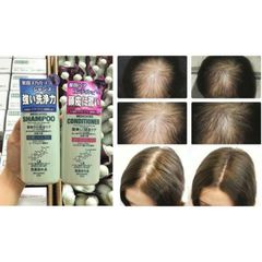 Dầu Gội & Xả KAMINOMOTO Nhật Bản 300ml - Giải Pháp Kích Thích Mọc Tóc Hiệu Quả, Chăm Sóc Sức Khỏe Tóc Tương Tác Thiên Nhiên