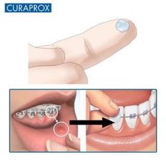 Sáp nha khoa Dentek Wax For Braces cho răng niềng 1 vỉ (USA)