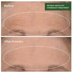 Tinh Chất Chống Lão Hóa Murad Retinal ReSculpt - Serum Tăng Độ Đàn Hồi & Săn Chắc Da, Trẻ Hóa Da Ban Đêm