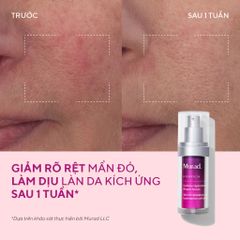 Tinh Chất Dưỡng Ẩm Murad Cellular Hydration Repair Serum 30ml - Phục Hồi, Tái Tạo Da, Làm Dịu & Nuôi Dưỡng Da Mặt