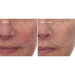 Tinh Chất Dưỡng Ẩm Murad Cellular Hydration Repair Serum 30ml - Phục Hồi, Tái Tạo Da, Làm Dịu & Nuôi Dưỡng Da Mặt