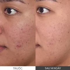 Tinh Chất Murad Rapid Dark Spot Correcting - Giảm Thâm Sạm, Làm Sáng Da, Ngăn Ngừa Đốm Nâu, Chăm Sóc Da Mặt