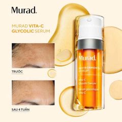 Tinh Chất Murad Vita C Glycolic Serum 30ml - Làm Trắng Sáng Da, Mờ Thâm, Đều Màu Da, Tăng Collagen Cho Làn Da Rạng Rỡ