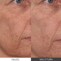 Tinh Chất Murad Vita C Glycolic Serum 30ml - Làm Trắng Sáng Da, Mờ Thâm, Đều Màu Da, Tăng Collagen Cho Làn Da Rạng Rỡ