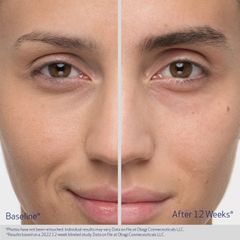 Serum Dưỡng Lông Mày OBAGI NUCIL - Tinh Chất Kích Thích Mọc Dày Tự Nhiên, Dưỡng Lông Mày Mềm Mượt, Trẻ Trung
