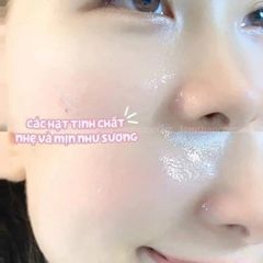 CNP Vita B Ampule Mist 50ml - Xịt Khoáng Làm Sáng Da, Dưỡng Ẩm, Giúp Làn Da Trắng Sáng Mịn Màng