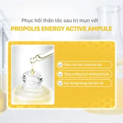 CNP Tinh Chất Keo Ong Propolis Energy Active Ampule - Kháng Khuẩn, Phục Hồi Da, Nuôi Dưỡng Da Tối Ưu