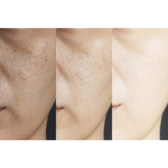 Tinh Chất Se Khít Lỗ Chân Lông DIEGO DALLA PALMA - Serum Giảm Dầu, Ngừa Mụn và Dưỡng Ẩm Mịn Da Cho Da Dầu và Hỗn Hợp