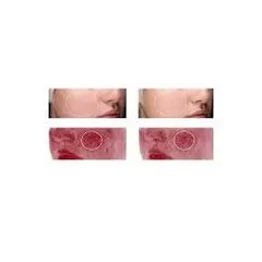 Kem Dưỡng Phục Hồi Da RVB LAB THE SKIN RICH với Pre-Probiotics, Dưỡng Ẩm và Chống Lão Hóa Cho Da Khô, Nhạy Cảm