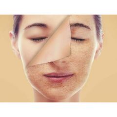 Serum Tái Sinh Da Lão Hóa EGF Diego Dalla Palma - Huyết Thanh Chống Lão Hóa, Phục Hồi và Trẻ Hóa Da, Phù Hợp Mọi Loại Da