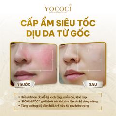 Mặt Nạ Ngủ Yococi Cao Cấp 30g - Dưỡng Trắng Da, Ngăn Ngừa Lão Hóa, Bổ Sung Dưỡng Chất Vitamin Từ Thiên Nhiên