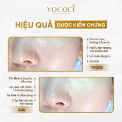 Kem Dưỡng Trắng Da Mặt Ngày & Đêm YOCOCI Perfect Face Cream 20g – Dưỡng Ẩm, Mờ Thâm Nám, Chống Oxy Hóa, Phục Hồi Da