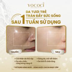 Nước Hoa Hồng Yococi Perfect Oolong Toner 110g - Dưỡng Da Mịn Màng, Cân Bằng Độ pH, Dưỡng Ẩm Cho Mọi Loại Da