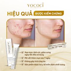 Gel Chấm Mụn YOCOCI Retinol Cao Cấp 15g – Giảm Mụn, Mờ Thâm, Ngừa Sẹo, Dưỡng Da Mịn Màng, Hỗ Trợ Làm Lành Vết Thương