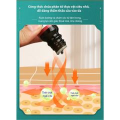 Tinh Dầu Ngải Cứu & Gừng - Chăm Sóc Da, Giảm Đau Đầu, Giúp Ngủ Sâu, Dưỡng Ẩm Tự Nhiên, Hỗ Trợ Làm Mờ Vết Rạn Da