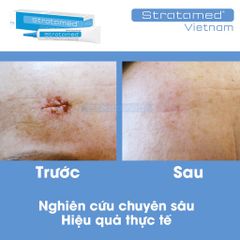 Combo Gel Silicone Strataderm & Stratamed cho vết thương hở, hỗ trợ ngăn ngừa sẹo xấu, làm mềm và phẳng vết sẹo, hiệu quả cao.